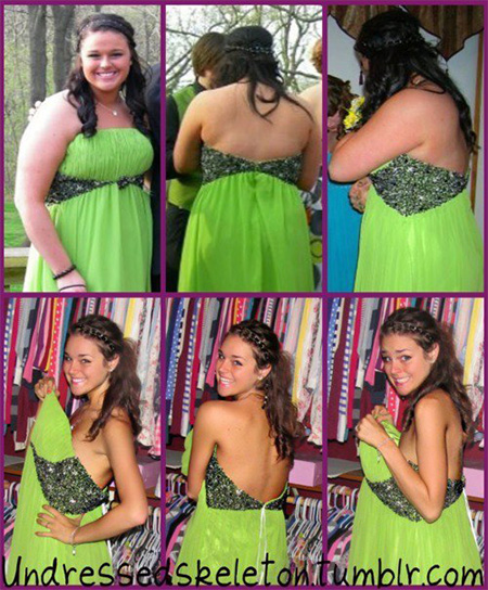 before-after-dress